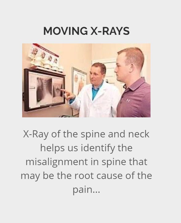 Lower Back Pain fairfax VA